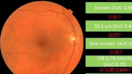 這張照片 可以看出性別、年齡、血壓